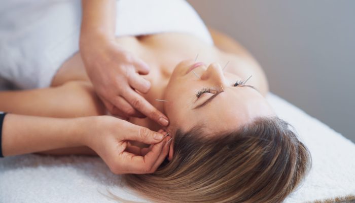 A acupuncture needle therapy in the studio. High quality photo